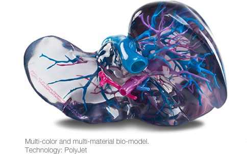 Stratasys 3D Printers Create Realistic Medical Training Models | IMSH 2017 Video Interview