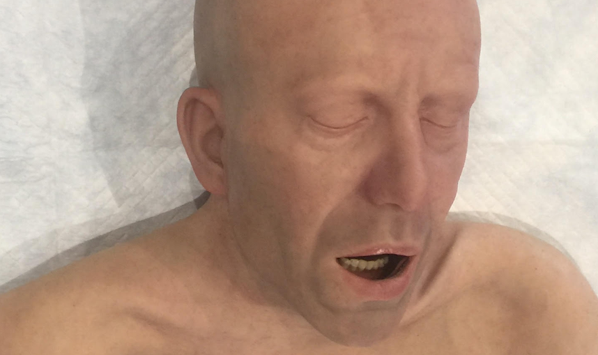 IMSH 2018 Starts with a Bang — SynDaver Acquires Lifecast Body Simulation