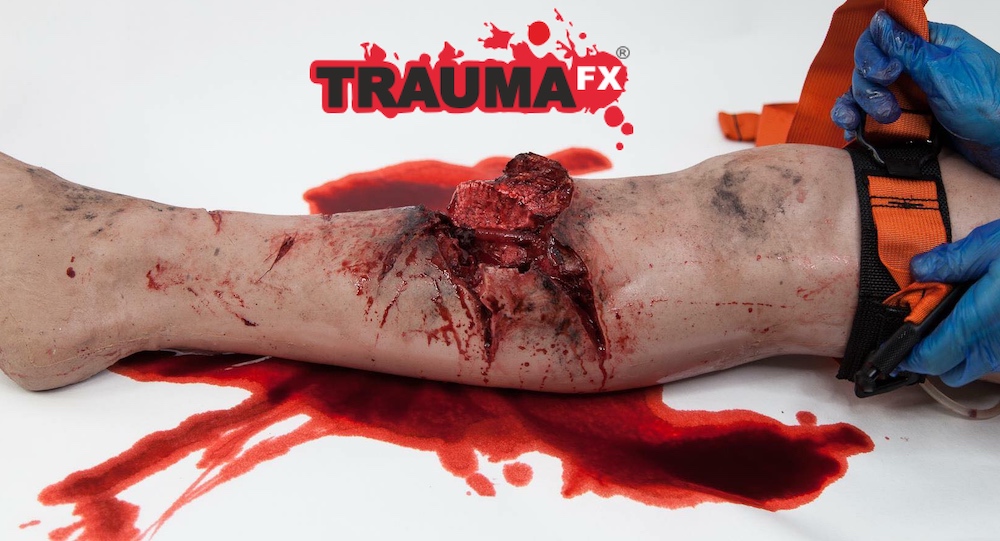 TraumaFX UK Provides Cutting Edge Moulage Products and Live Actor Training Services