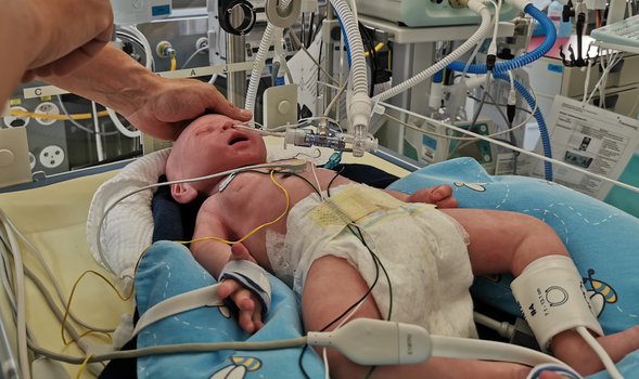 Baby Lung Simulator LuSi Responds to Respiratory Therapy