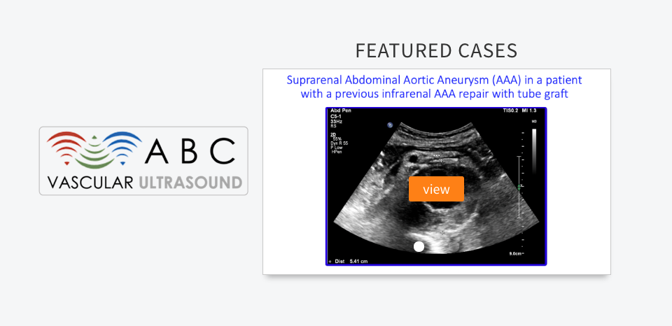 Free Vascular Ultrasound Medical Simulation Case Library