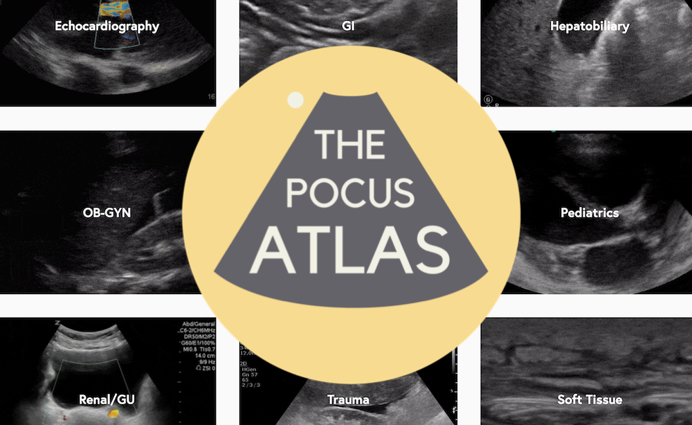 The Point of Care Ultrasound Atlas Provides Free Ultrasound Simulation Resources