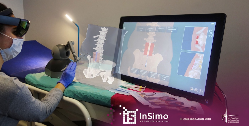 InSimo Offers Biomechanical Software & Development for Surgical Simulation Training