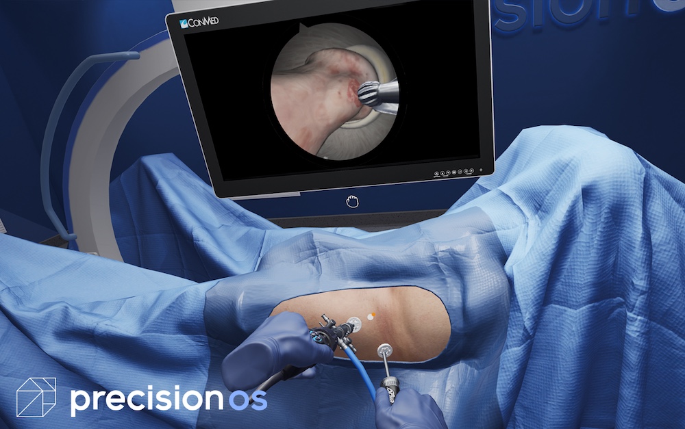 Study Shows 50% Reduction in Critical Surgical Errors After PrecisionOS VR Healthcare Simulation Training
