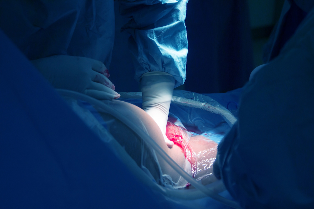 How to Run a Postpartum Hemorrhage Nursing Simulation Scenario
