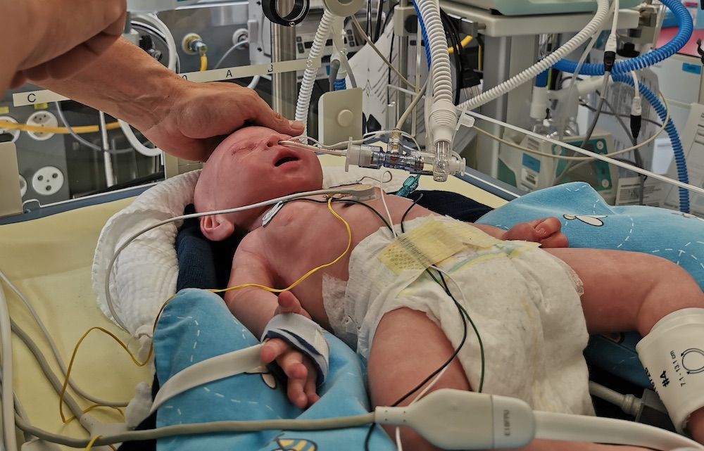 Neonatal Lung Simulator LuSi from neosim Creates Realistic Pediatric Ventilator Training