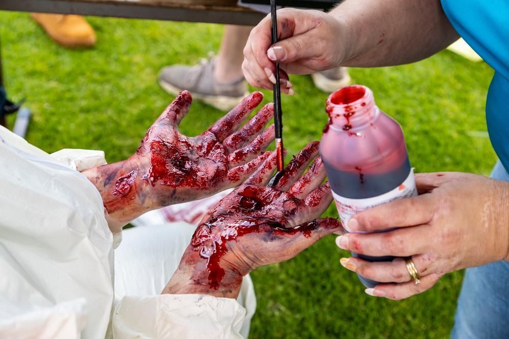 July 4th Fireworks Burn Moulage for Trauma Training