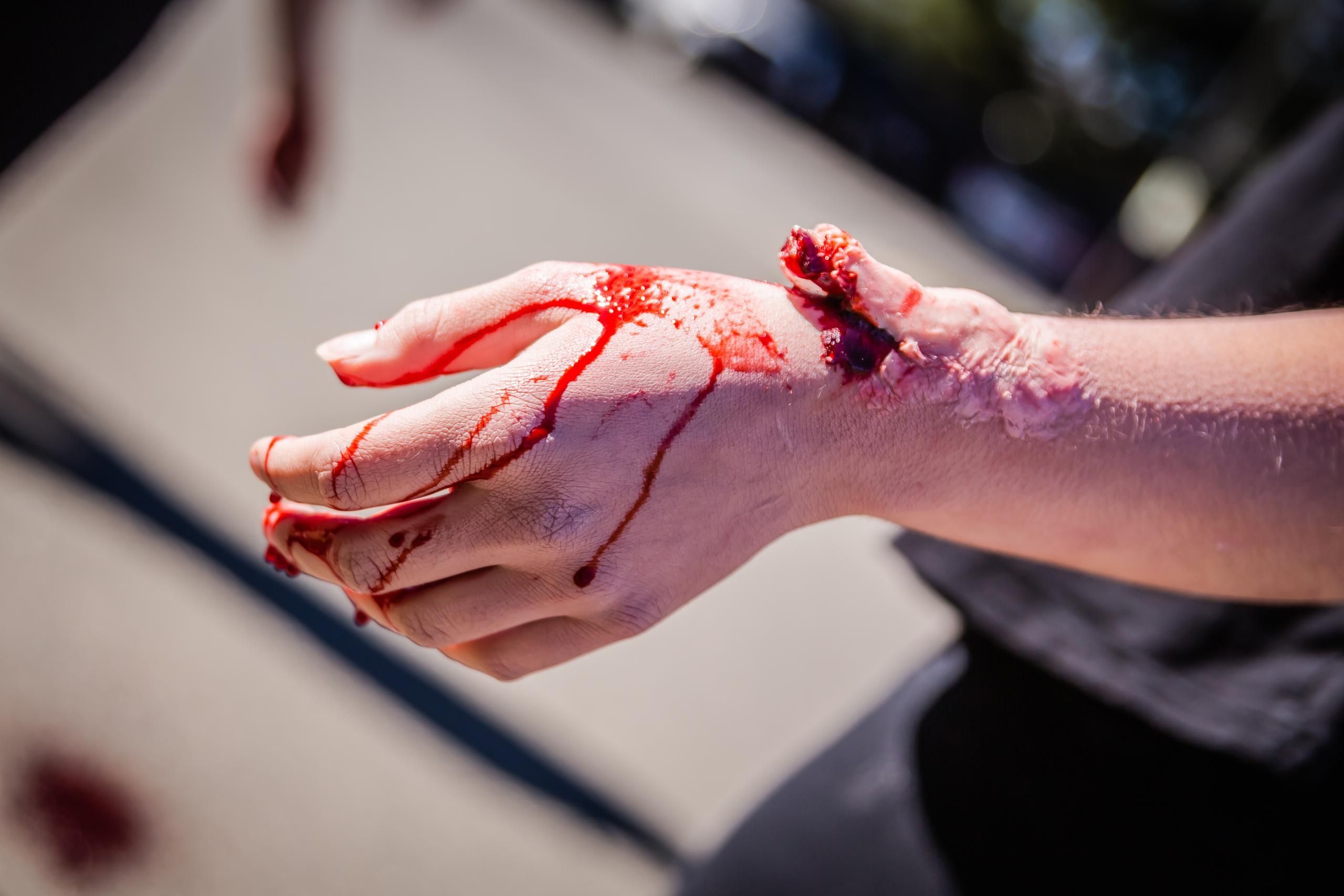 Boo-Boos and Bandages: Halloween Moulage in the Sim Lab