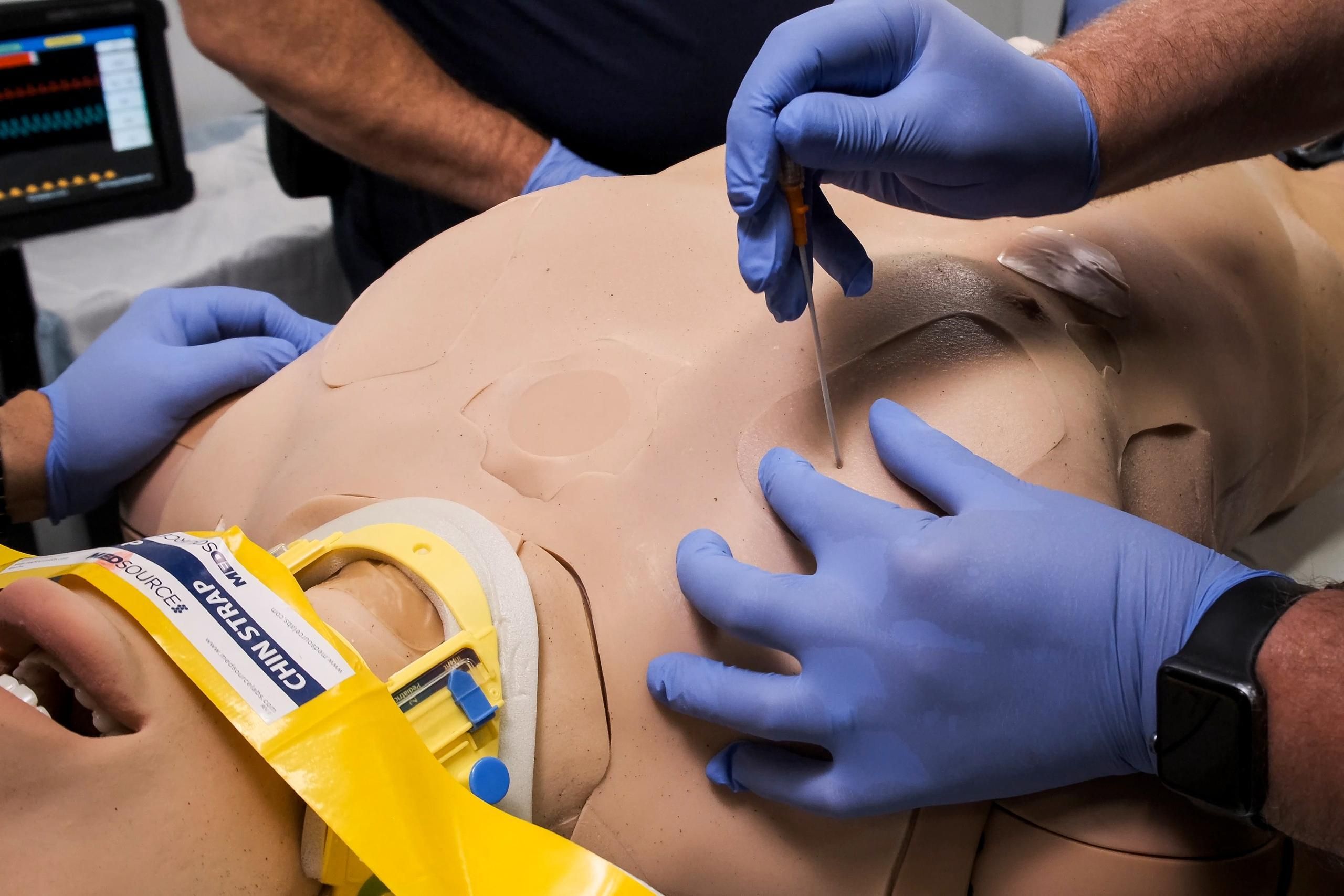 Simulating Tension Pneumothorax: A Primer for Trauma Simulation Training