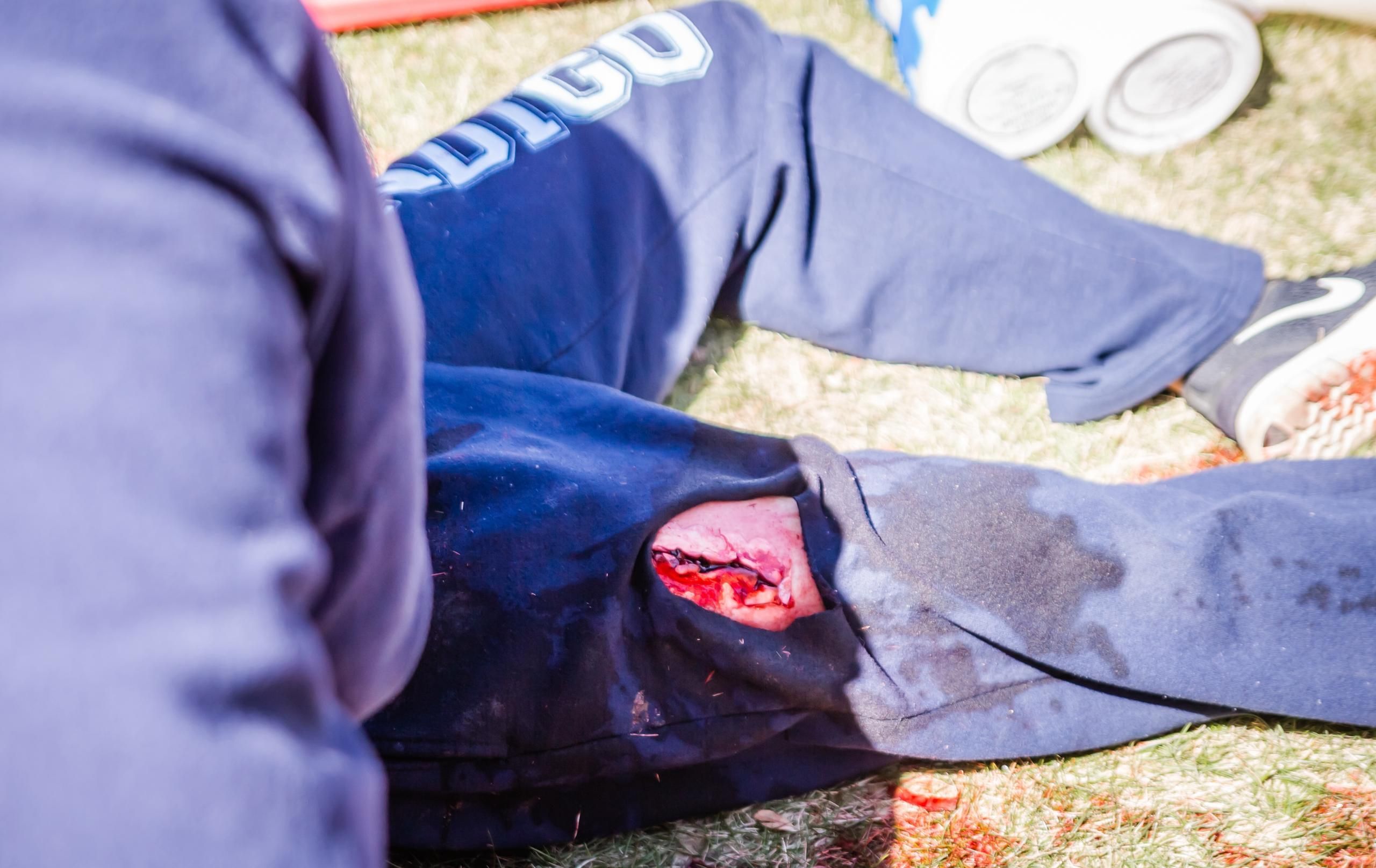 Downloadable Moulage Checklist Balances Realism and Educational Value
