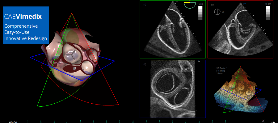 CAE Vimedix: 3 Ultrasound Simulator Configurations in Just 1 Platform